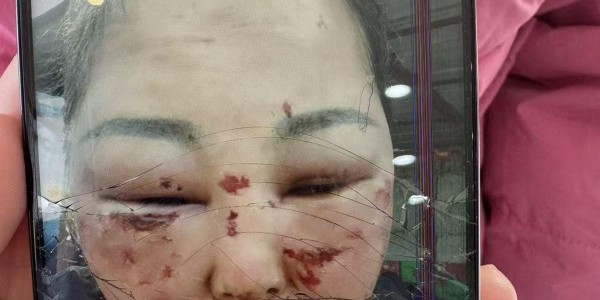 被前夫打进ICU的女子情况仍不稳定，其8岁女儿也曾遭父亲扇脸，律师：已构成故意伤害罪，或同时涉虐待罪