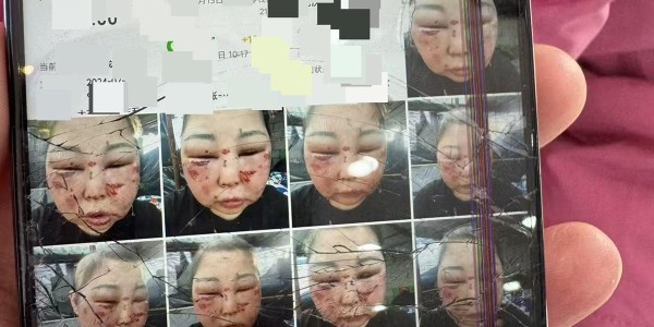 被前夫打进ICU的女子情况仍不稳定，其8岁女儿也曾遭父亲扇脸，律师：已构成故意伤害罪，或同时涉虐待罪